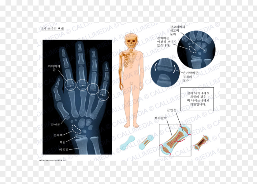 Esqueleto Pediatrics Medicine PNG