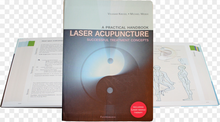 Laser Treatment Electronic Filter Design Handbook, Fourth Edition Acupuncture Low-level Therapy PNG
