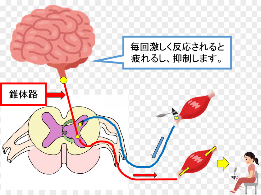 Brain Tendon Reflex Ankle Jerk Achilles PNG