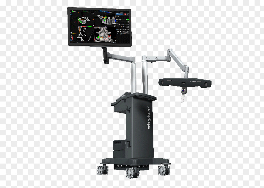 Stryker Corporation Computer-assisted Surgery Navigation System PNG