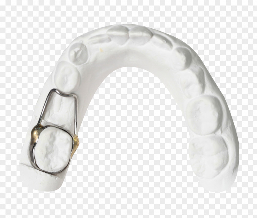 Tooth Whitening Mouth Dentistry Horse PNG