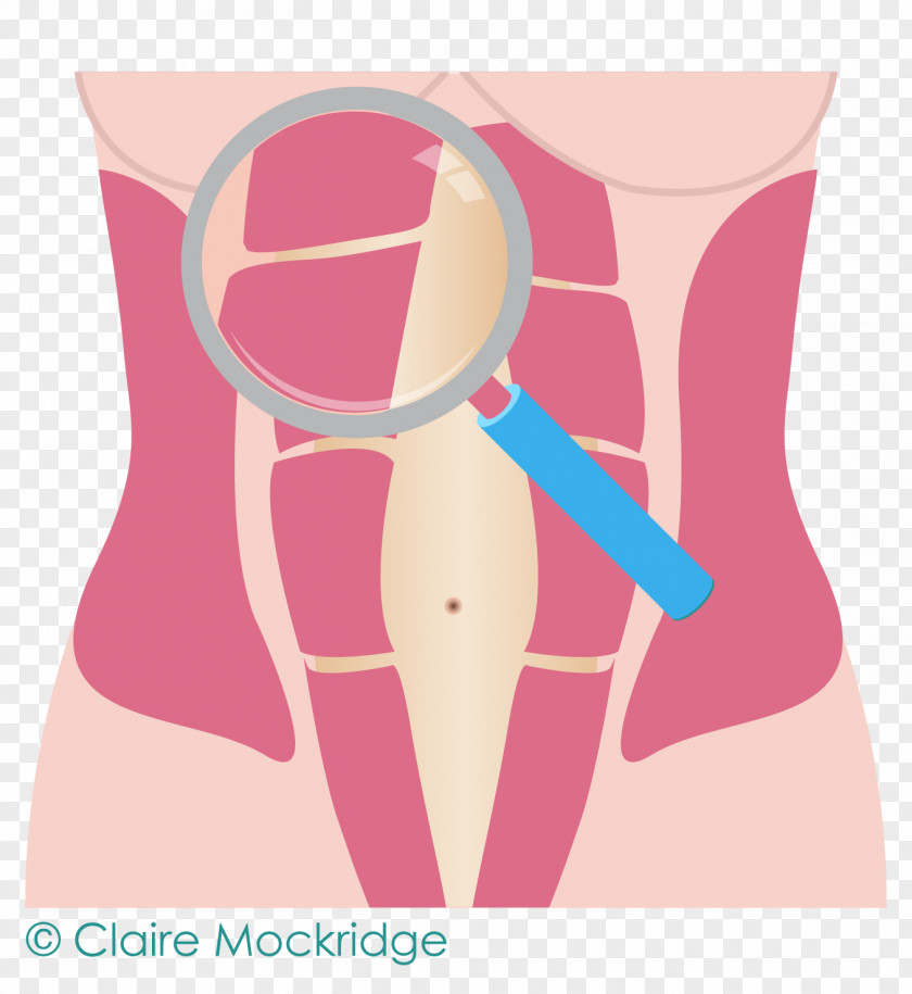 Abdominal Movement Diastasis Recti Hip Abdomen Rectus Abdominis Muscle PNG