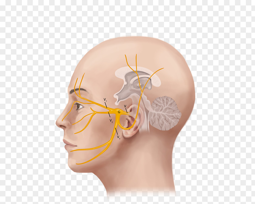 Ear Trigeminal Nerve Neuralgia Headache PNG