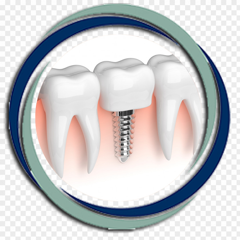Dr. Bradley Hepler Dental RestorationCrown Implant Dentistry Atlanta Center For Health PNG