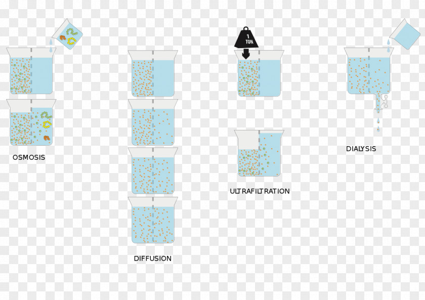 Hemodialysis Kidney Ultrafiltration Renal Replacement Therapy PNG