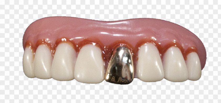 Gold Dentures Human Tooth Teeth PNG