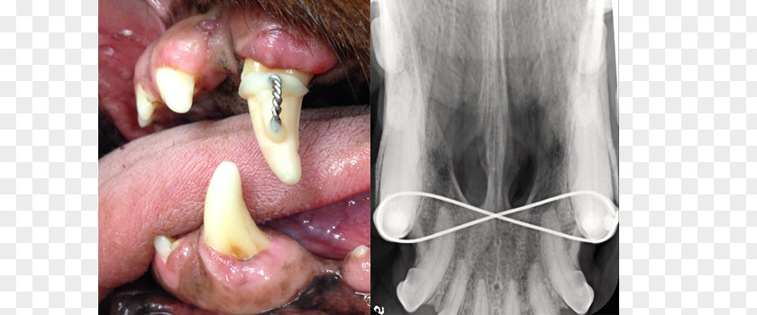 Canine Tooth Mouth Maxillary Human PNG