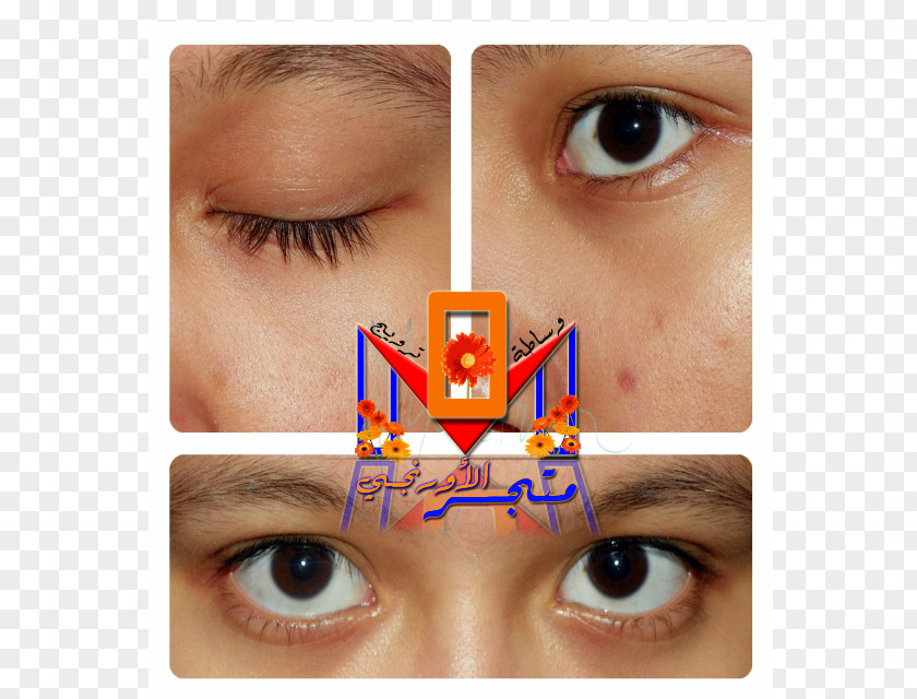 Women Eyes Eyelash Extensions Collagen Muhammad Periorbital Dark Circles PNG