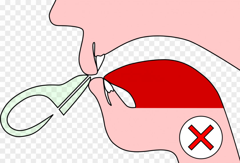 Bad Result Ocarina Lip Mouthpiece Tooth Clip Art PNG
