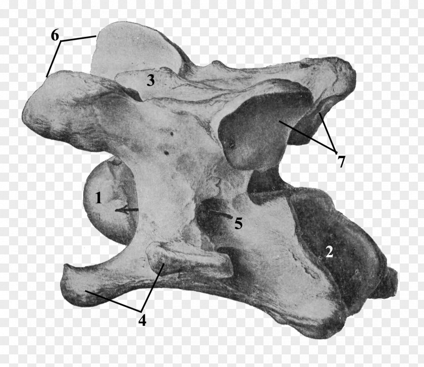 Cervical Vertebrae Axis Anatomy Skull PNG