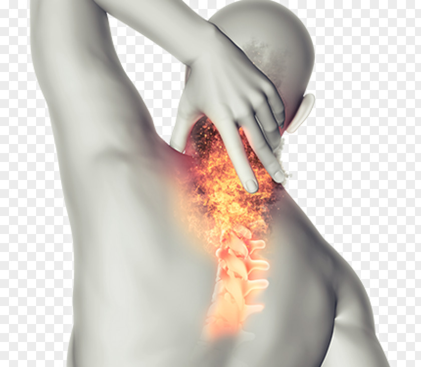 Neck Pain Back Management Human PNG