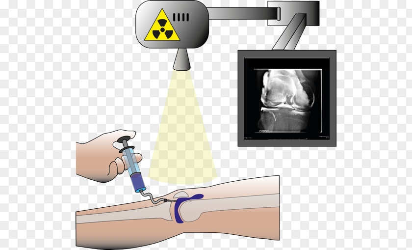 St. Thomas Injection Radiology Arthrogram Computed Tomography Magnetic Resonance Imaging PNG