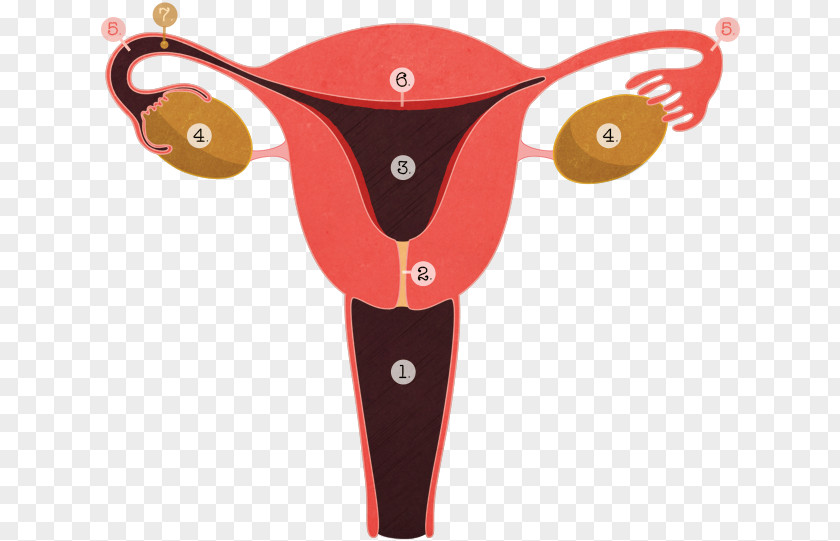 Contraception Tubal Ligation Ligature Menstruation Adenomyosis Reproductive System PNG