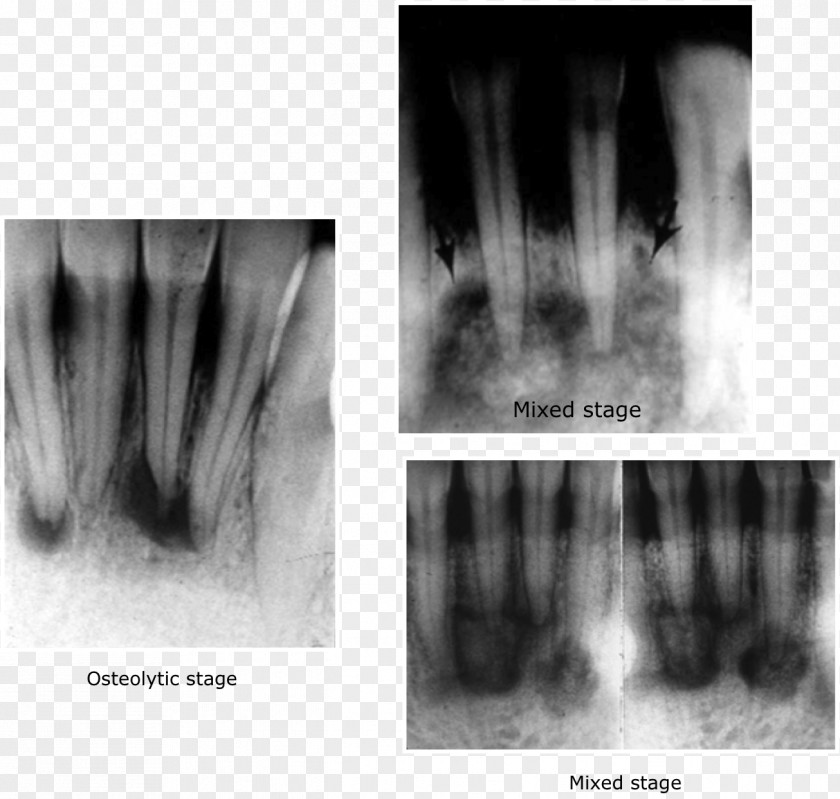 Medical Radiography X-ray Imaging Magnetic Resonance PNG radiography imaging resonance imaging, others clipart PNG