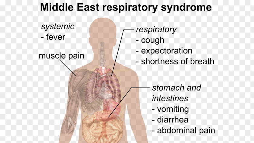 Health Public Middle East Respiratory Syndrome Severe Acute Pandemic PNG