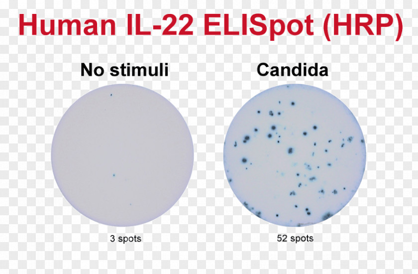 ELISPOT Assay B Cell Granzyme Secretion PNG