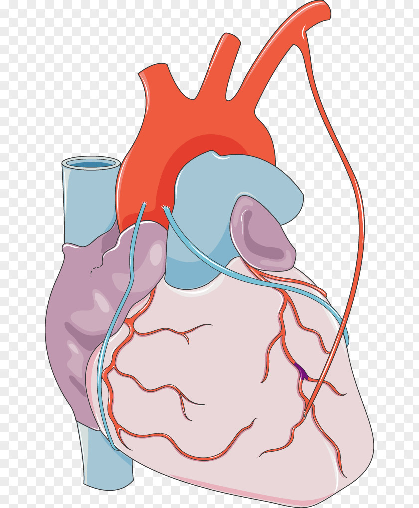 Anatomy Heart Art Myocardial Infarction Monocyte Coronary Artery Disease Medical Clip PNG