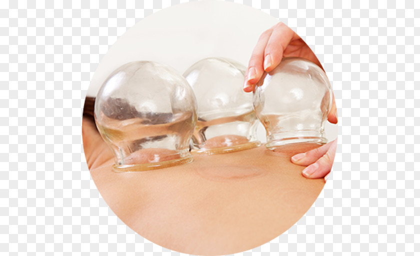 Cupping Therapy Pain In Spine Acupuncture Traditional Chinese Medicine PNG