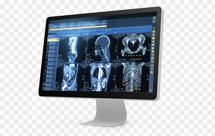 Splat Picture Archiving And Communication System DICOM Medical Imaging Physician Hospital PNG