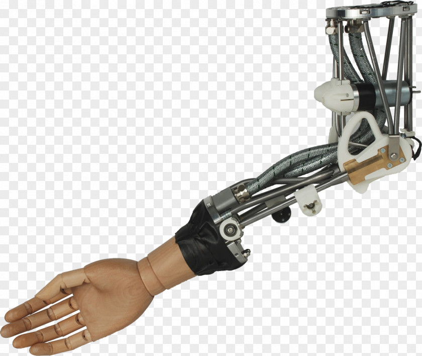 Arm Prosthetic Hand Robotic Prosthesis Bionics PNG