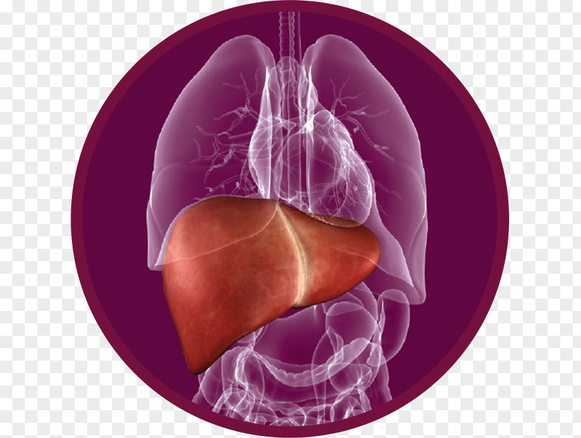 Fatty Liver Disease Therapy Cirrhosis PNG