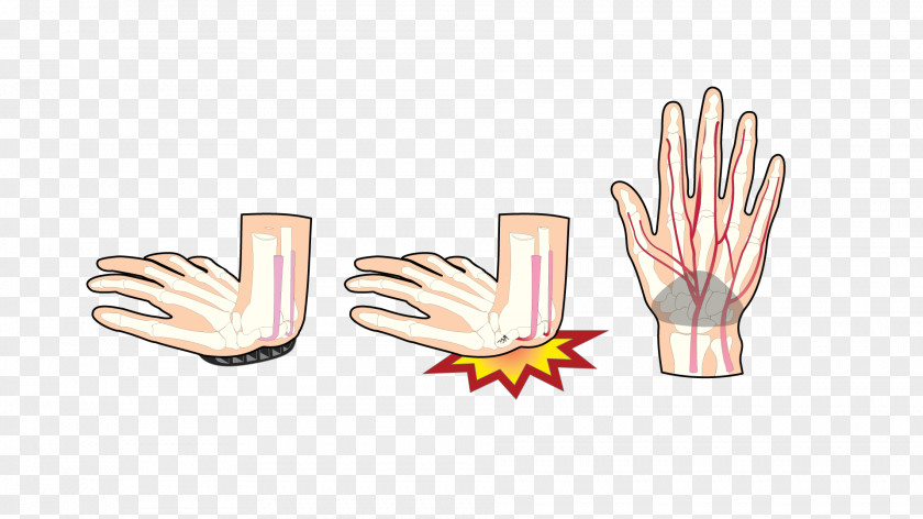 Palm Clipart Hand Model Thumb PNG