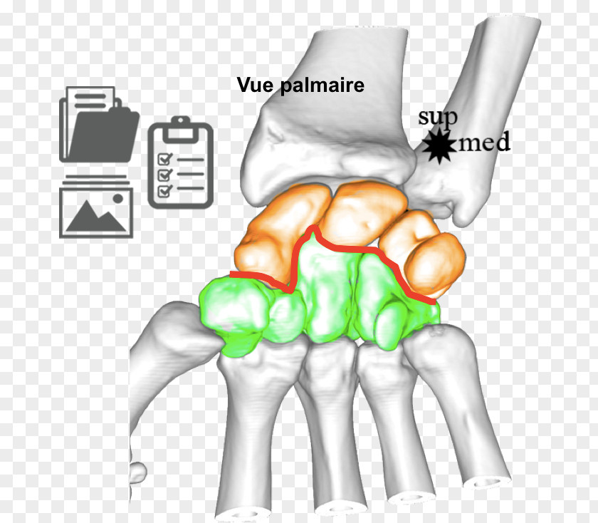 Carpe Thumb Ulnar Nerve Wrist Joint Human Anatomy PNG
