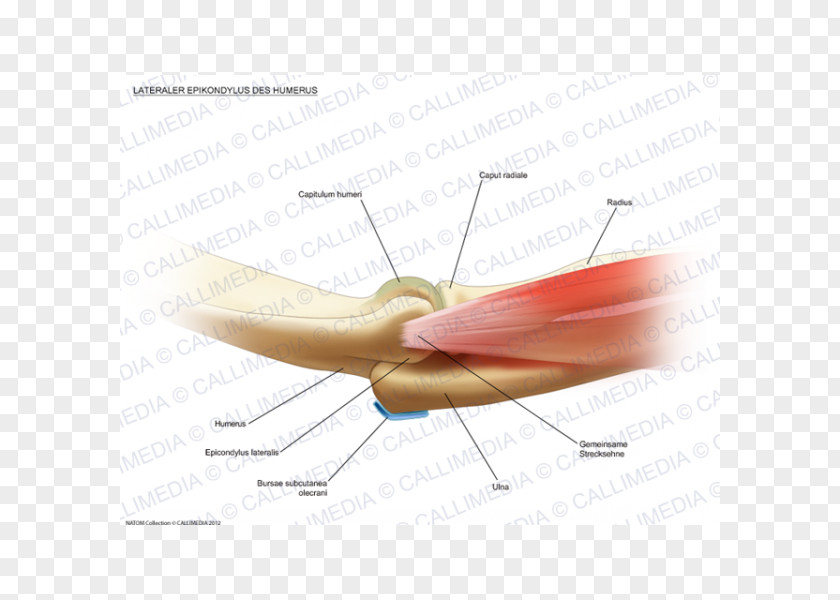 Elbow Cartoon Tennis Lateral Epicondyle Of The Humerus Tendon PNG