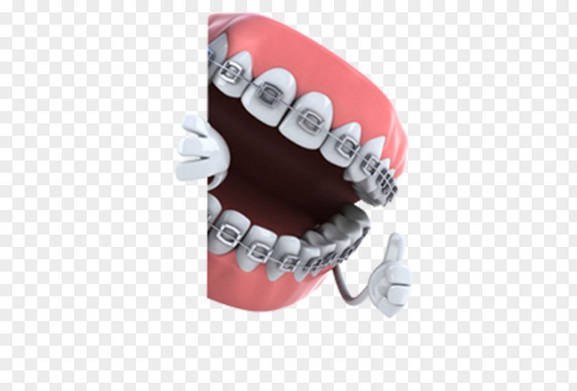 Health Dentistry Orthodontics Dental Braces Tooth Medicine PNG