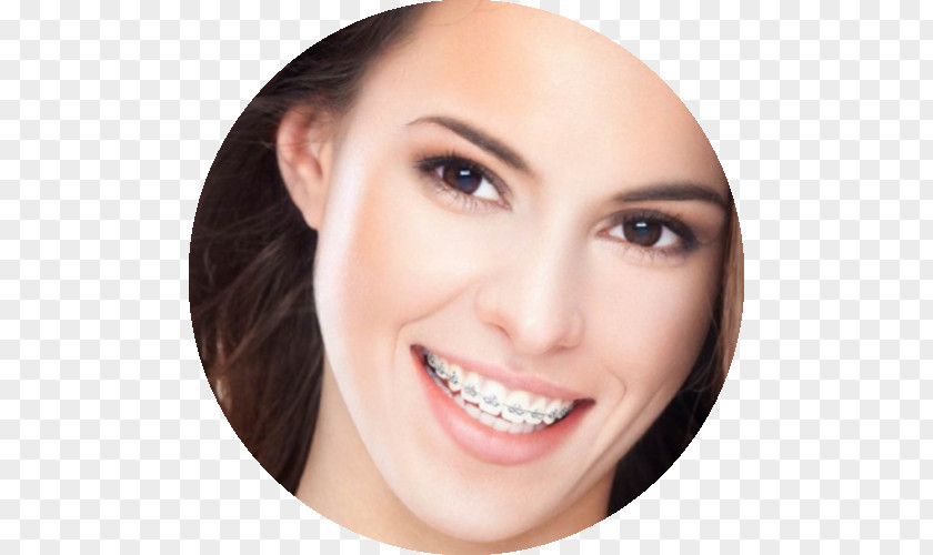 Health Dental Braces Orthodontics Dentistry Tooth PNG