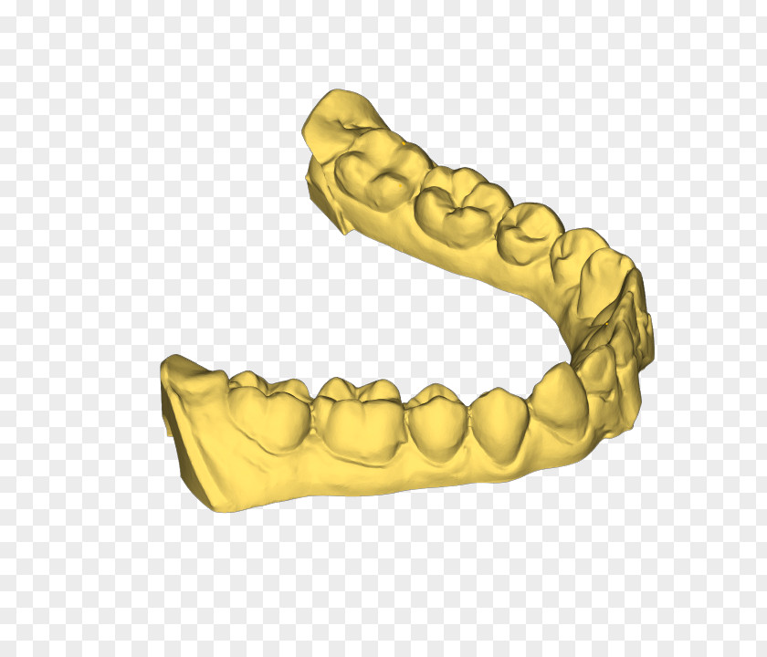 3d Dental Treatment For Toothache 3D Printing Printer Arch Dentistry PNG