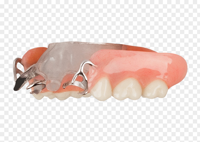 Dentistry Tooth Dentures Aspen Dental Evansville PNG