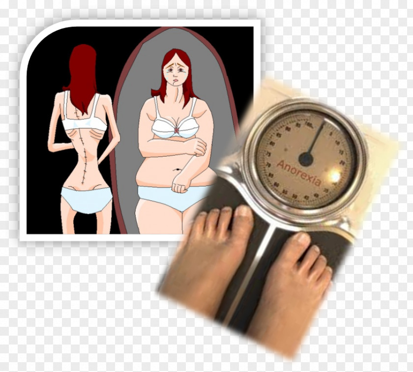 Anorexia Nervosa Binge Eating Disorder Bulimia Poor Appetite PNG