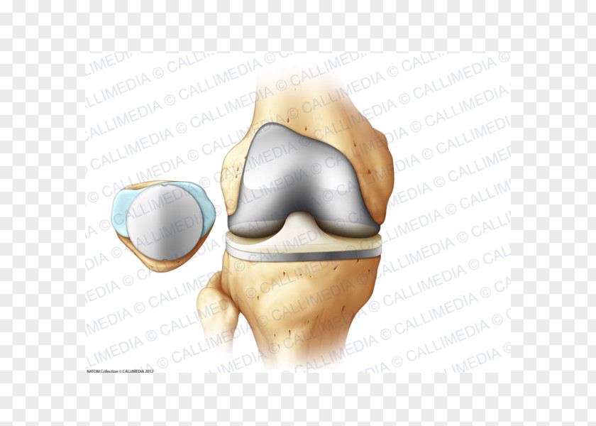 Artrosis De Rodilla Bone Fracture Hypertension Surgery Cardiology PNG