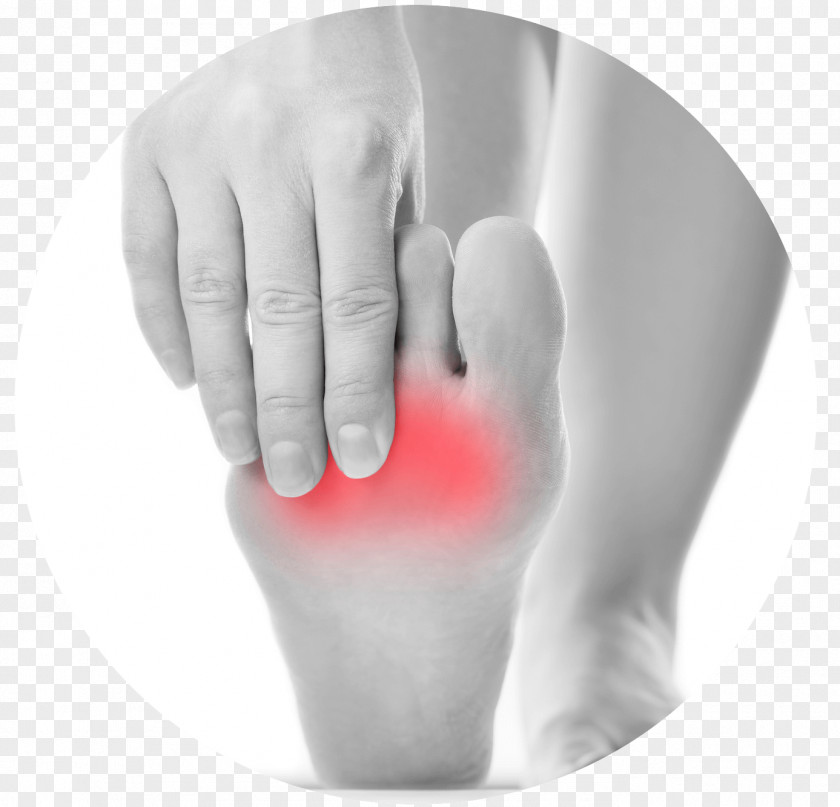 Foot Pain Morton's Neuroma Ball Podiatry PNG