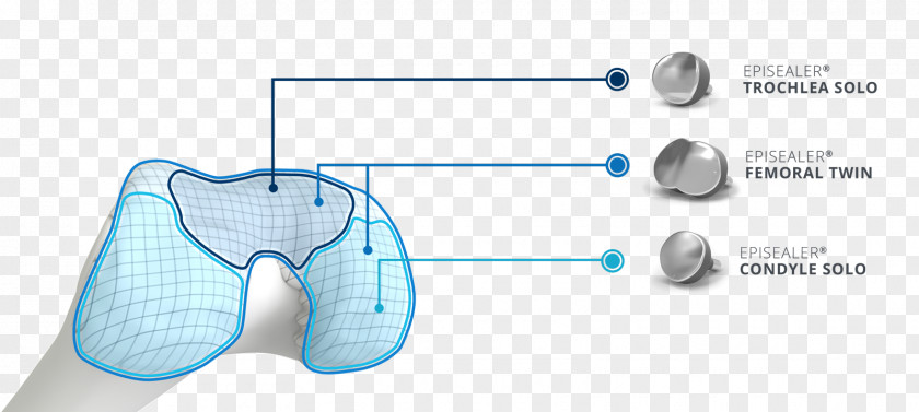 Implants Knee Replacement Implant Joint Cartilage PNG