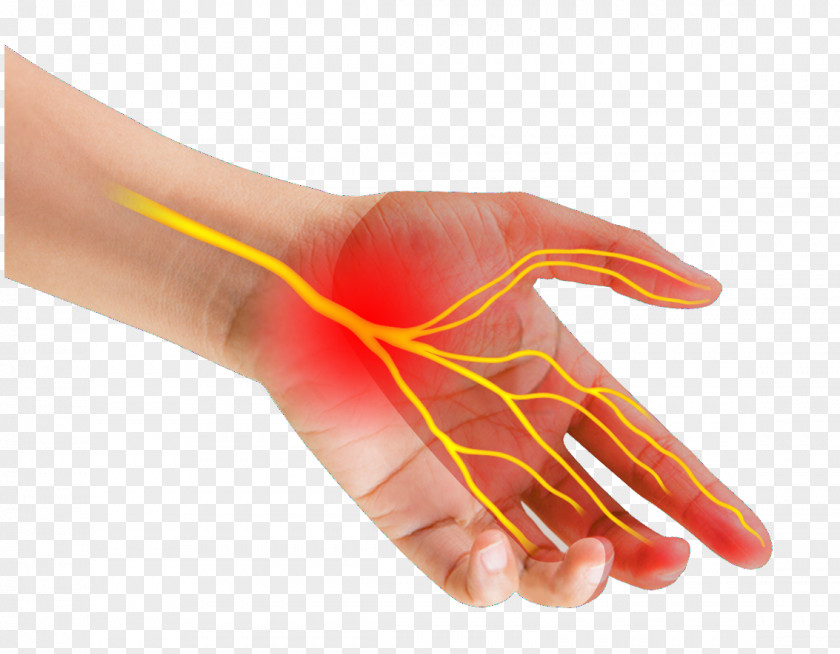 Go Home Thumb Carpal Tunnel Syndrome Median Nerve Wrist PNG