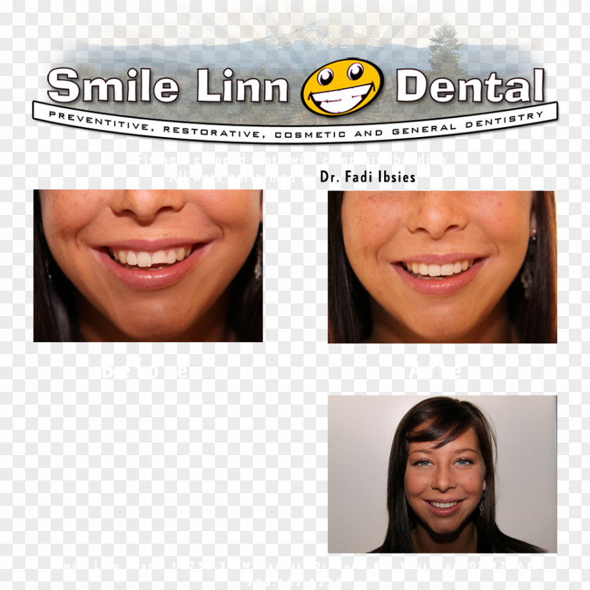 Dental Smile Lake Oswego Linn Dental: Ibsies Fadi B DMD Willamette River Dentist Willamette, Oregon PNG