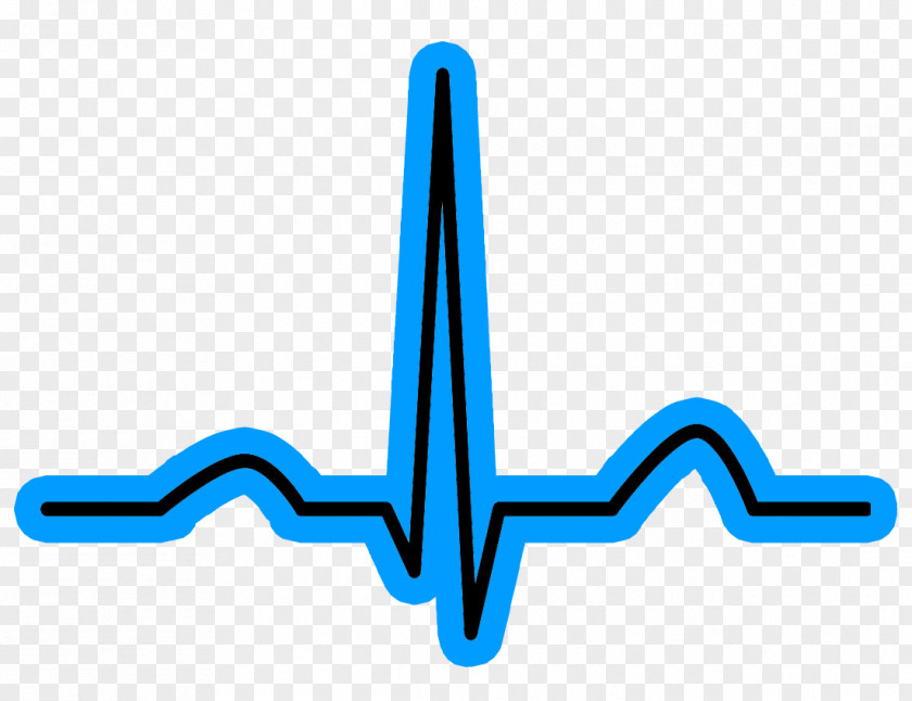 Sinus Rhythm Music Training Heart Arrhythmia PNG rhythm arrhythmia, abnormal condition clipart PNG