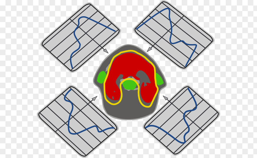 Mri Cliparts Magnetic Resonance Imaging Computed Tomography Clip Art PNG