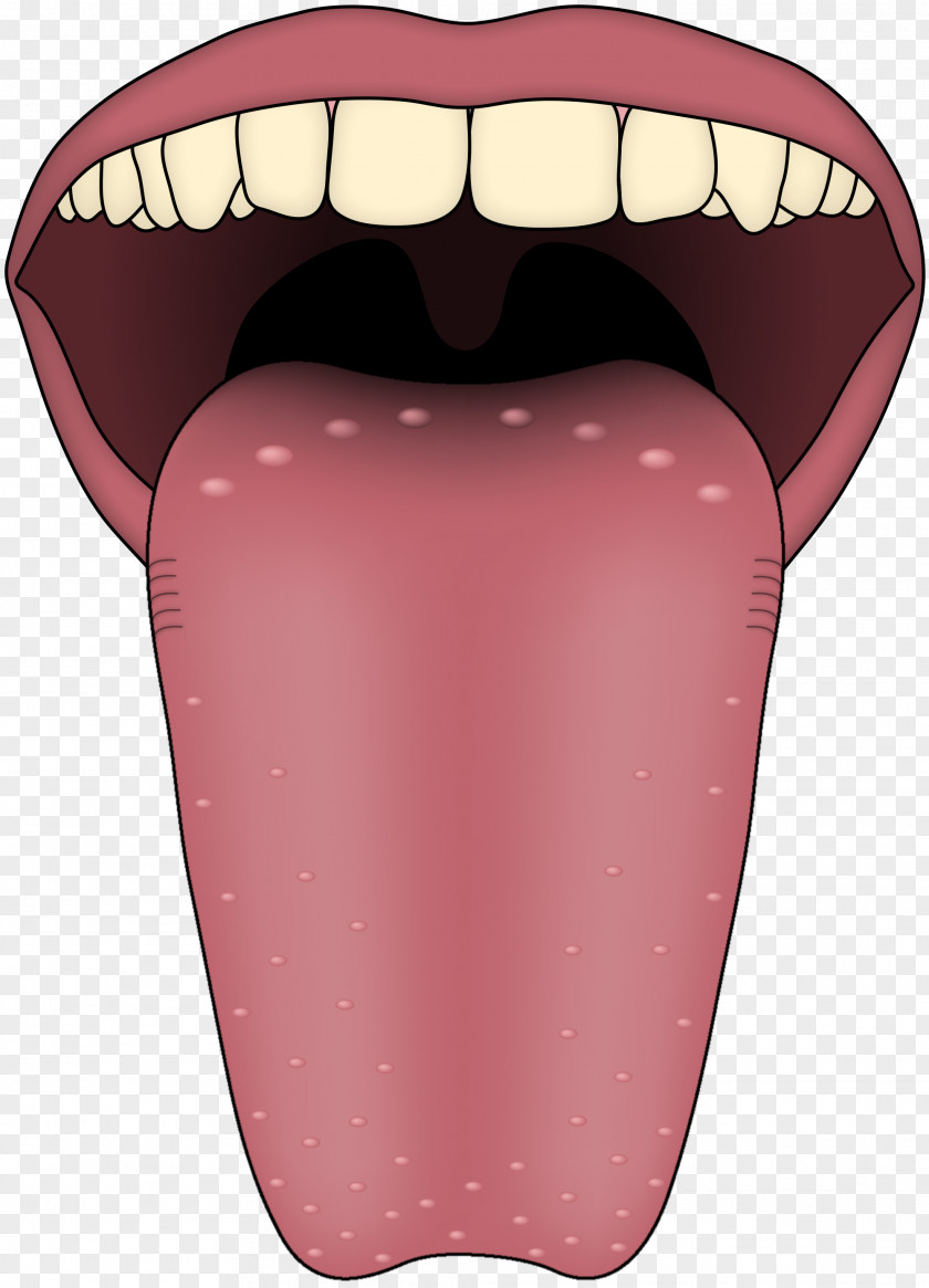 Tongue Transient Lingual Papillitis Taste Bud Papillae PNG