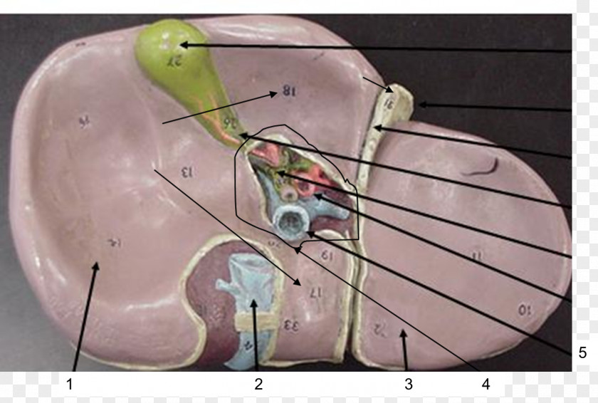 Sonography Porta Hepatis Lymph Node Liver Anatomy PNG