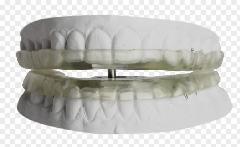 Temporomandibular Joint Dysfunction Orthodontics Dentistry Mouthguard PNG