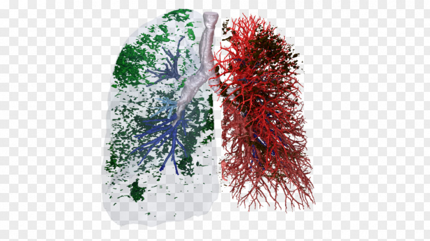 Unicat Catalyst Technologies European Respiratory Society Idiopathic Pulmonary Fibrosis Tract Chronic Obstructive Disease Lung PNG