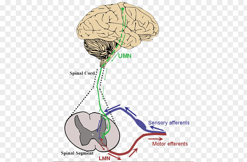 Brain Amyotrophic Lateral Sclerosis Upper Motor Neuron Lower PNG