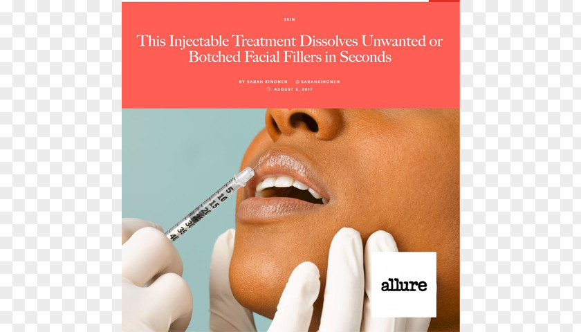 Lip Augmentation Hyaluronic Acid Injectable Filler Restylane PNG