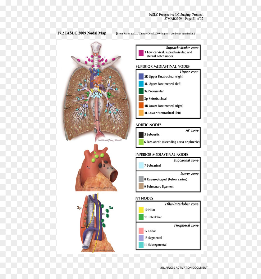 Lung Cancer Lymph Node Staging Anatomy PNG