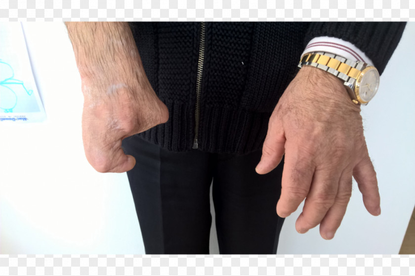 Riflesso Thumb Sleeve Wrist Shoulder Hip PNG