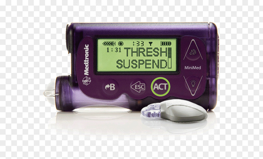 Artificial Pancreas Insulin Pump Minimed Paradigm Diabetes Mellitus Continuous Glucose Monitor Management PNG