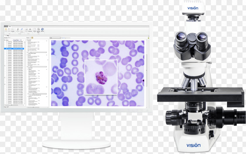 Microscope Quartan Malaria Technology PNG
